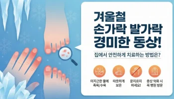 겨울철 손가락 발가락 경미한 동상 증상, 집에서 안전하게 치료하는 방법은 무엇일까? 동상 초기 증상, 손가락 동상, 발가락 동상, 1도 동상, 동상 응급처치, 동창 동상 차이, 동상 치료법, 겨울철 피부관리, 손끝 감각 저하, 동상 물집