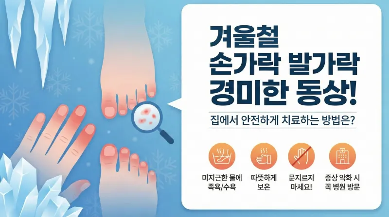 동상 초기 증상, 손가락 동상, 발가락 동상, 1도 동상, 동상 응급처치, 동창 동상 차이, 동상 치료법, 겨울철 피부관리, 손끝 감각 저하, 동상 물집